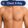 man's chest with chest x-ray label